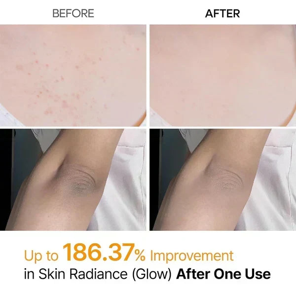 Dr Melaxin™️ Peel Shot Spray