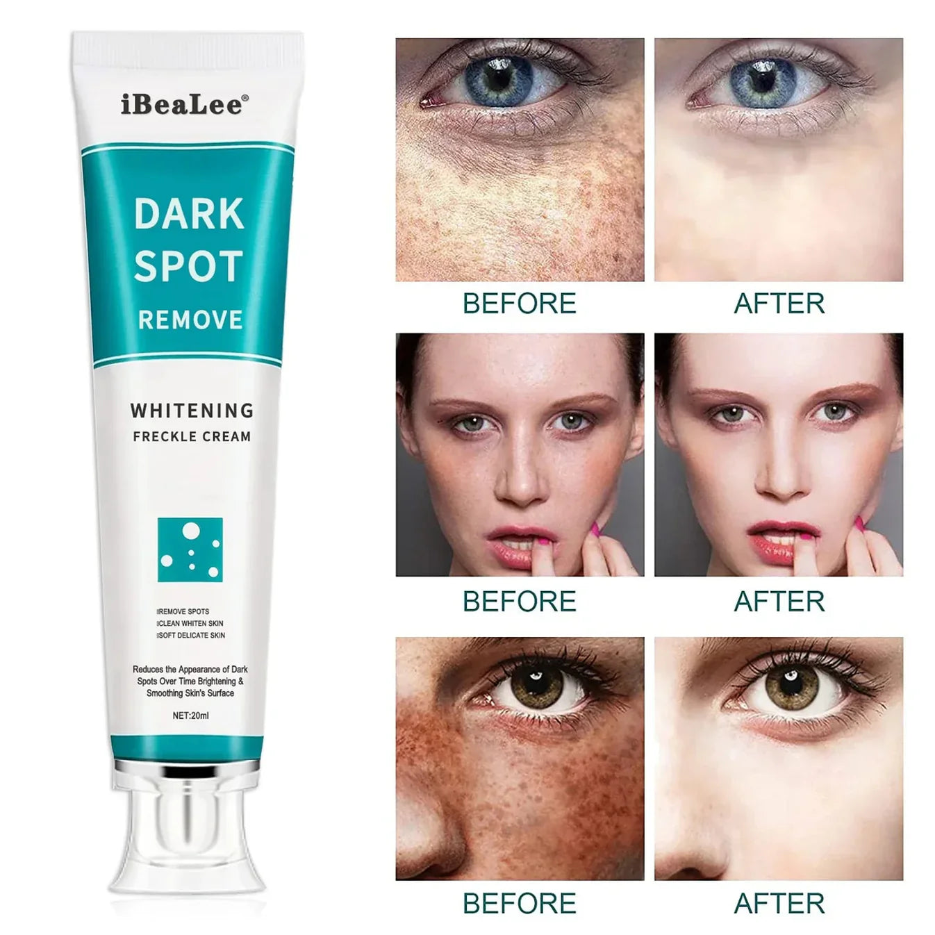 Dark Spots Remover